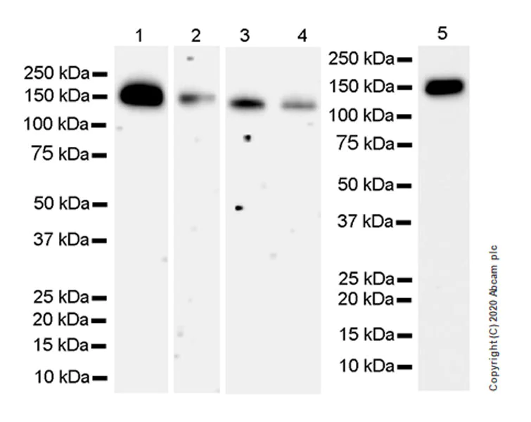 Western blot - Anti-Calcium channel L type DHPR alpha 2 subunit/CACNA2D1 antibody [EPR23267-8] (AB253190)