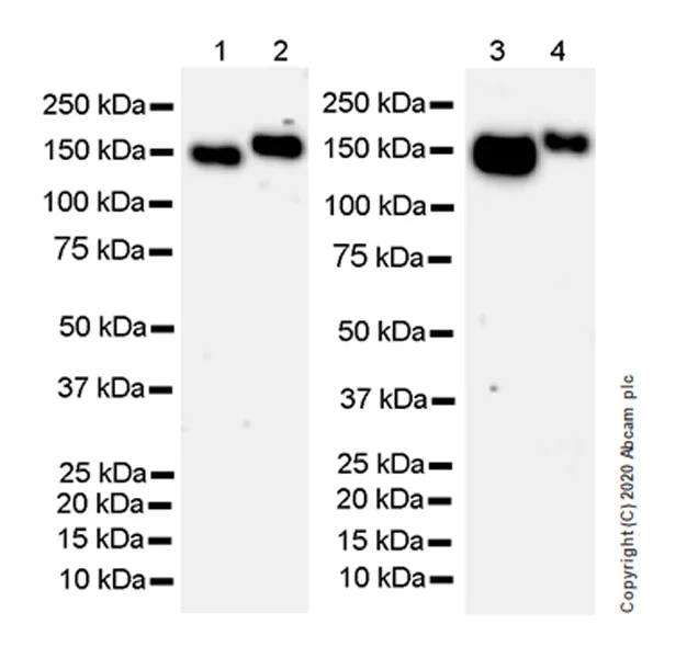 Western blot - Anti-Calcium channel L type DHPR alpha 2 subunit/CACNA2D1 antibody [EPR23267-8] (AB253190)
