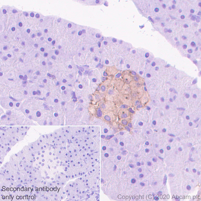 Immunohistochemistry (Formalin/PFA-fixed paraffin-embedded sections) - Anti-Calcium channel L type DHPR alpha 2 subunit/CACNA2D1 antibody [EPR23267-8] - BSA and Azide free (AB273881)