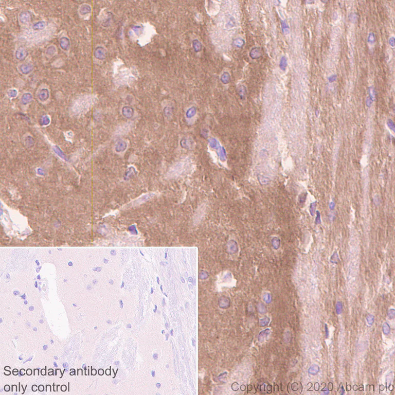 Immunohistochemistry (Formalin/PFA-fixed paraffin-embedded sections) - Anti-Calcium channel L type DHPR alpha 2 subunit/CACNA2D1 antibody [EPR23267-8] - BSA and Azide free (AB273881)