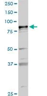 Western blot - Anti-Calcium-independent Phospholipase A2/PLA2G6 antibody (AB104416)