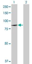Western blot - Anti-Calcium-independent Phospholipase A2/PLA2G6 antibody (AB104416)