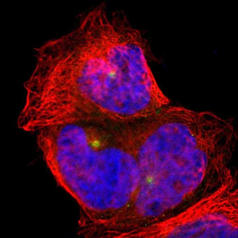 Immunocytochemistry/ Immunofluorescence - Anti-Calcium-independent Phospholipase A2/PLA2G6 antibody (AB244247)