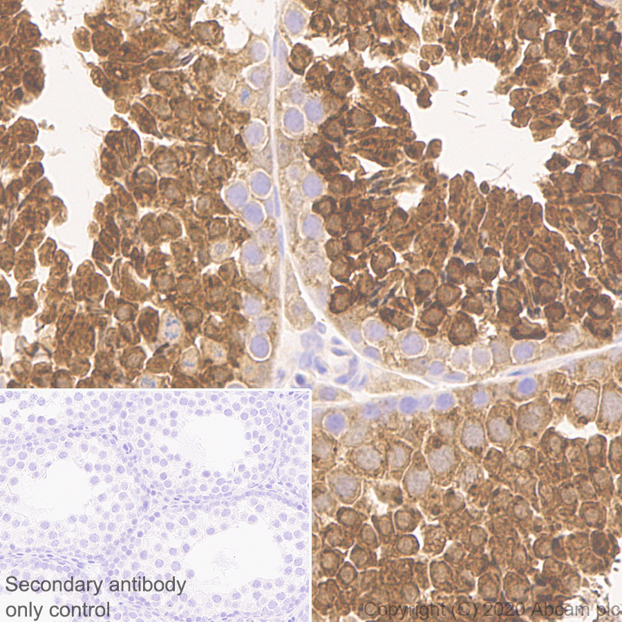 Immunohistochemistry (Formalin/PFA-fixed paraffin-embedded sections) - Anti-Calcium-independent Phospholipase A2/PLA2G6 antibody [EPR23994-103] (AB259950), expandable thumbnail