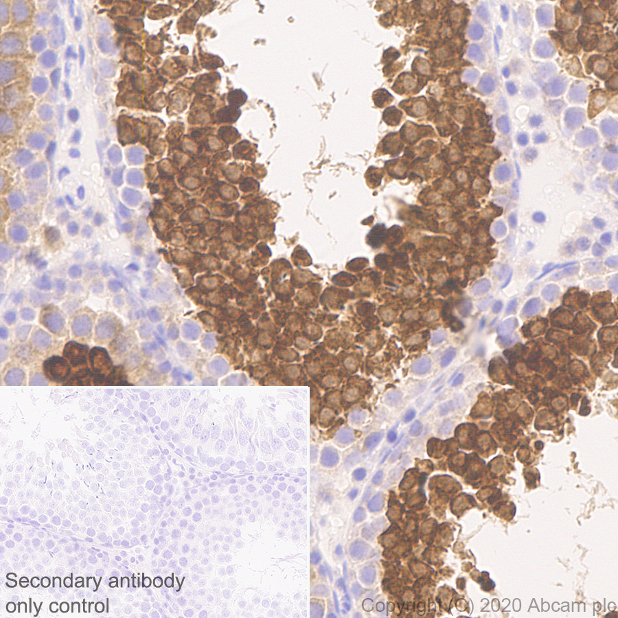 Immunohistochemistry (Formalin/PFA-fixed paraffin-embedded sections) - Anti-Calcium-independent Phospholipase A2/PLA2G6 antibody [EPR23994-103] (AB259950), expandable thumbnail