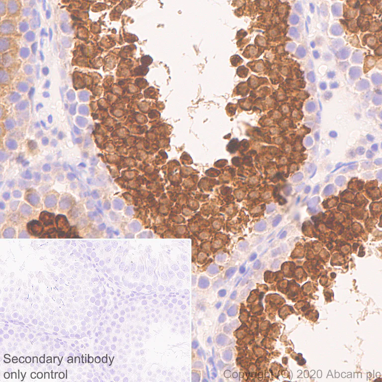Immunohistochemistry (Formalin/PFA-fixed paraffin-embedded sections) - Anti-Calcium-independent Phospholipase A2/PLA2G6 antibody [EPR23994-103] (AB259950)