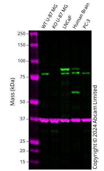 Western blot - Anti-Calcium-independent Phospholipase A2/PLA2G6 antibody [EPR23994-103] (ab259950), expandable thumbnail