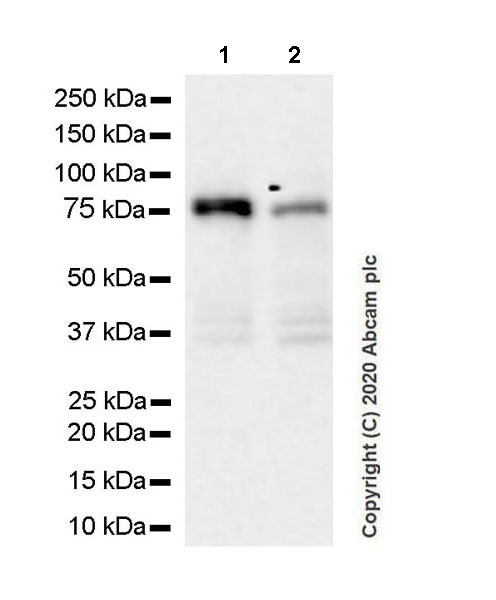 Western blot - Anti-Calcium-independent Phospholipase A2/PLA2G6 antibody [EPR23994-103] (AB259950), expandable thumbnail