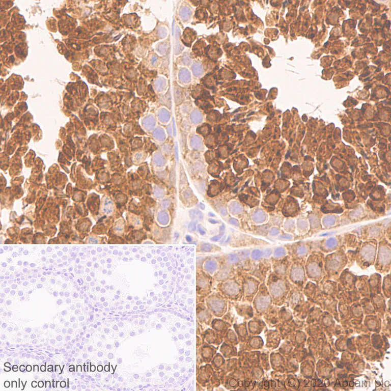 Immunohistochemistry (Formalin/PFA-fixed paraffin-embedded sections) - Anti-Calcium-independent Phospholipase A2/PLA2G6 antibody [EPR23994-103] - BSA and Azide free (AB278086)