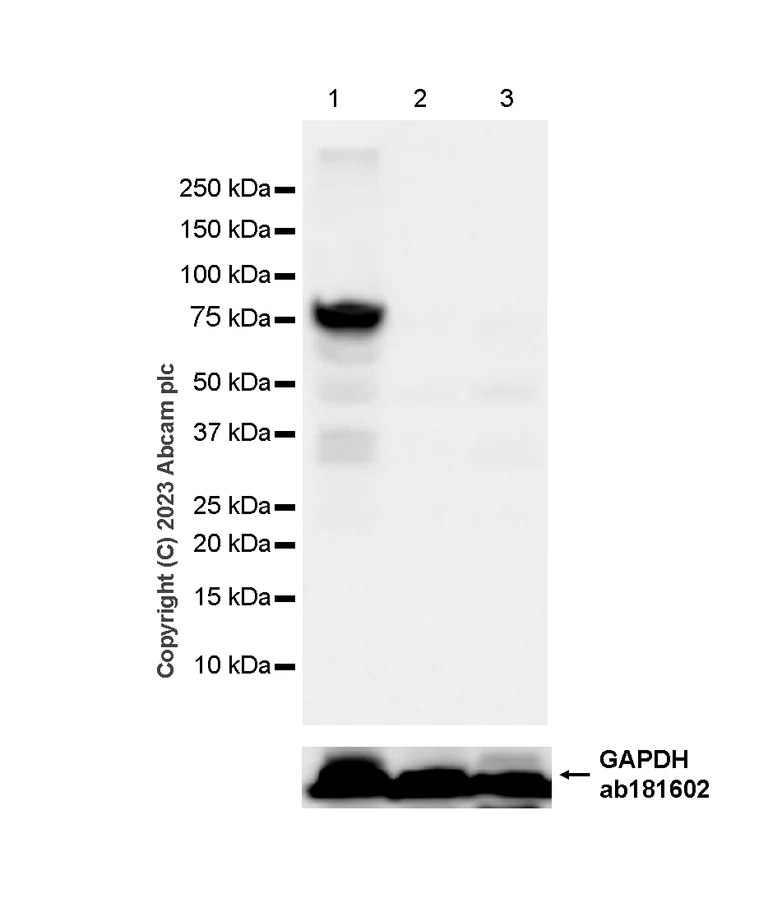 Western blot - Anti-Calcium-independent Phospholipase A2/PLA2G6 antibody [EPR23994-103] - BSA and Azide free (AB278086)