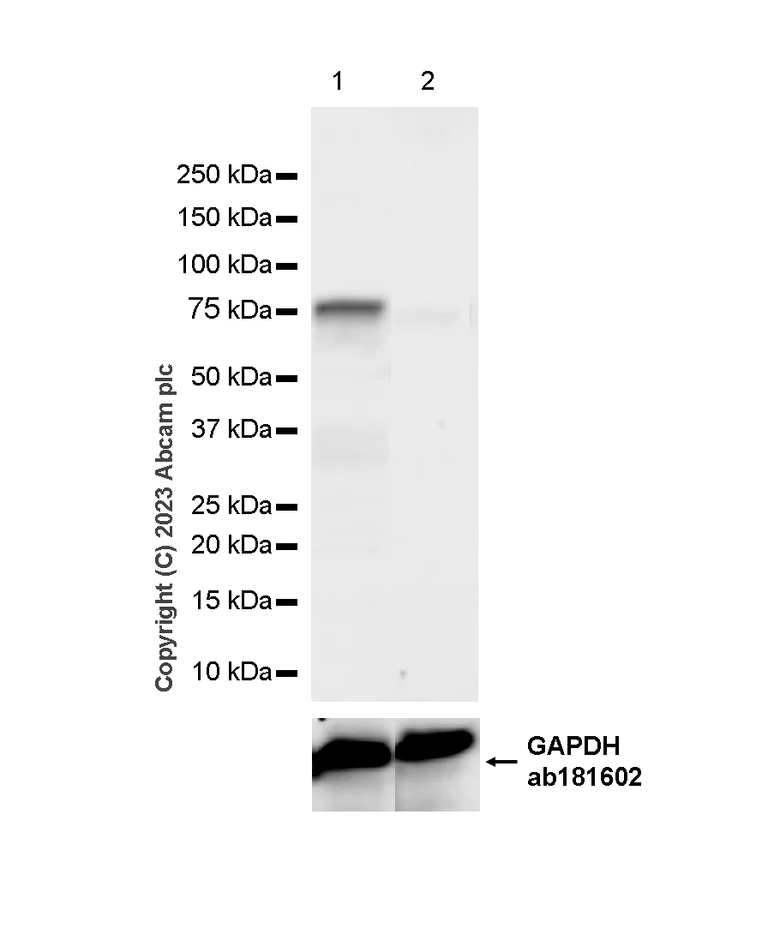 Western blot - Anti-Calcium-independent Phospholipase A2/PLA2G6 antibody [EPR23994-103] - BSA and Azide free (AB278086)
