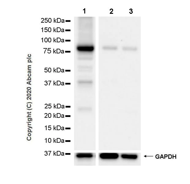 Western blot - Anti-Calcium-independent Phospholipase A2/PLA2G6 antibody [EPR23994-103] - BSA and Azide free (AB278086)