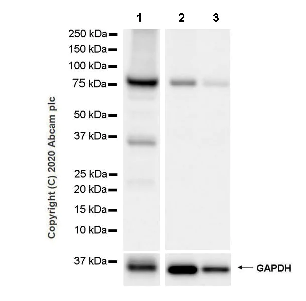 Western blot - Anti-Calcium-independent Phospholipase A2/PLA2G6 antibody [EPR23994-103] - BSA and Azide free (AB278086)