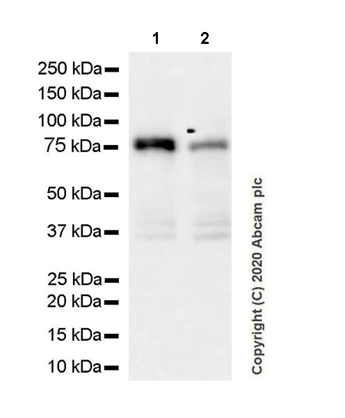 Western blot - Anti-Calcium-independent Phospholipase A2/PLA2G6 antibody [EPR23994-103] - BSA and Azide free (AB278086)