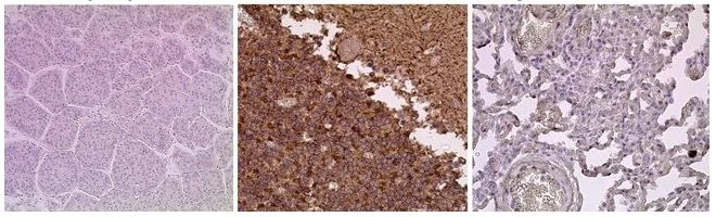 Immunohistochemistry (Formalin/PFA-fixed paraffin-embedded sections) - Anti-Calcium Pump PMCA2 ATPase antibody (AB3529)