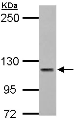 Western blot - Anti-Calcium Pump PMCA3 ATPase antibody (AB154213)