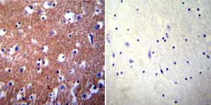 Immunohistochemistry (Formalin/PFA-fixed paraffin-embedded sections) - Anti-Calcium Pump PMCA3 ATPase antibody (AB3530)