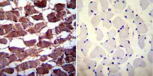 Immunohistochemistry (Formalin/PFA-fixed paraffin-embedded sections) - Anti-Calcium Pump PMCA3 ATPase antibody (AB3530)