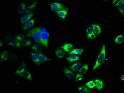 Immunocytochemistry/ Immunofluorescence - Anti-Calcium Pump PMCA4 ATPase antibody (AB238158)