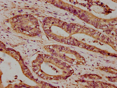 Immunohistochemistry (Formalin/PFA-fixed paraffin-embedded sections) - Anti-Calcium Pump PMCA4 ATPase antibody (AB238158)