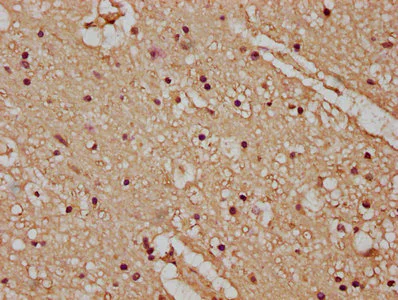 Immunohistochemistry (Formalin/PFA-fixed paraffin-embedded sections) - Anti-Calcium Pump PMCA4 ATPase antibody (AB238158)
