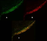Immunocytochemistry - Anti-Calcium Pump PMCA4 ATPase antibody [JA9] (ab2783), expandable thumbnail