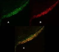 Immunocytochemistry - Anti-Calcium Pump PMCA4 ATPase antibody [JA9] (AB2783)