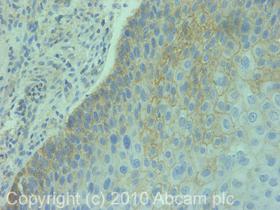 Immunohistochemistry (Formalin/PFA-fixed paraffin-embedded sections) - Anti-Calcium Pump PMCA4 ATPase antibody [JA9] (AB2783), expandable thumbnail