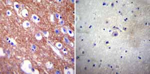 Immunohistochemistry (Formalin/PFA-fixed paraffin-embedded sections) - Anti-Calcium Pump PMCA4 ATPase antibody [JA9] (ab2783), expandable thumbnail