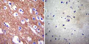 Immunohistochemistry (Formalin/PFA-fixed paraffin-embedded sections) - Anti-Calcium Pump PMCA4 ATPase antibody [JA9] (AB2783)