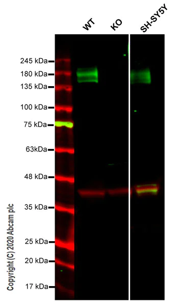 Western blot - Anti-Calcium Pump PMCA4 ATPase antibody [JA9] (AB2783)