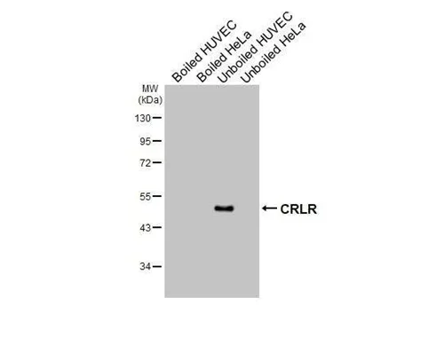 Western blot - Anti-CALCRL antibody [HL3876] - BSA and Azide free (AB325847)