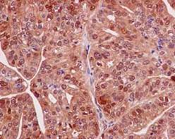 Immunohistochemistry (Formalin/PFA-fixed paraffin-embedded sections) - Anti-calcyphosine antibody [EPR15631] - BSA and Azide free (AB250894), expandable thumbnail