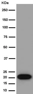 Western blot - Anti-calcyphosine antibody [EPR15631] - BSA and Azide free (AB250894)