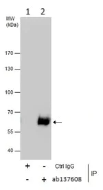 Immunoprecipitation - Anti-CalDAG-GEFI antibody (AB137608)