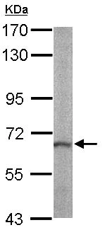 Western blot - Anti-CalDAG-GEFI antibody (AB137608)