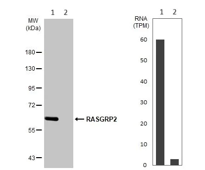 Western blot - Anti-CalDAG-GEFI antibody (AB137608)