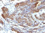 Immunohistochemistry (Formalin/PFA-fixed paraffin-embedded sections) - Anti-Caldesmon/CDM antibody [CALD1/820] (AB216011)