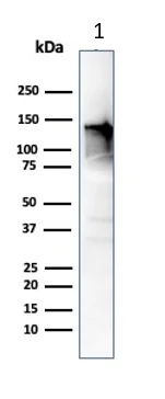 Western blot - Anti-Caldesmon/CDM antibody [CALD1/820] (AB216011)