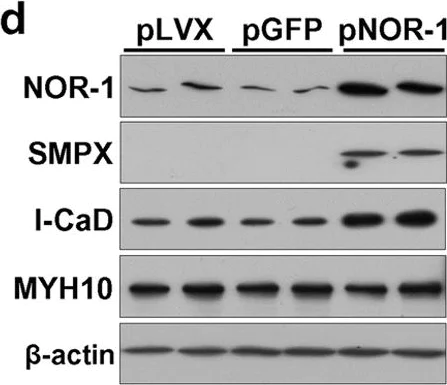 Western blot - Anti-Caldesmon/CDM antibody [E89] (AB32330)