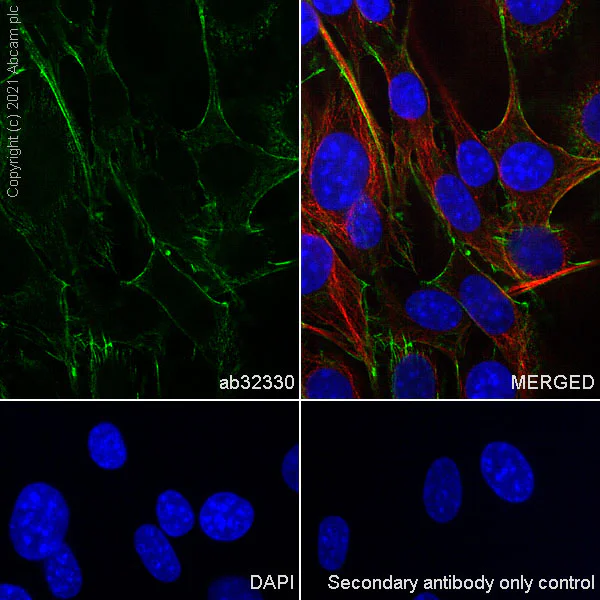 Immunocytochemistry/ Immunofluorescence - Anti-Caldesmon/CDM antibody [E89] - BSA and Azide free (AB215275)