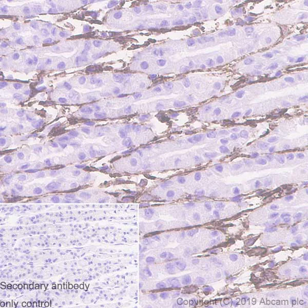 Immunohistochemistry (Formalin/PFA-fixed paraffin-embedded sections) - Anti-Caldesmon/CDM antibody [E89] - BSA and Azide free (AB215275)