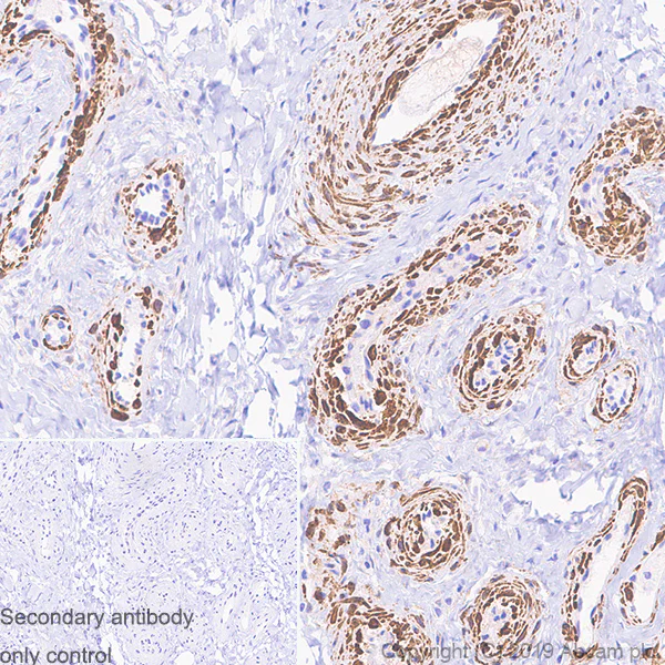 Immunohistochemistry (Formalin/PFA-fixed paraffin-embedded sections) - Anti-Caldesmon/CDM antibody [E89] - BSA and Azide free (AB215275)