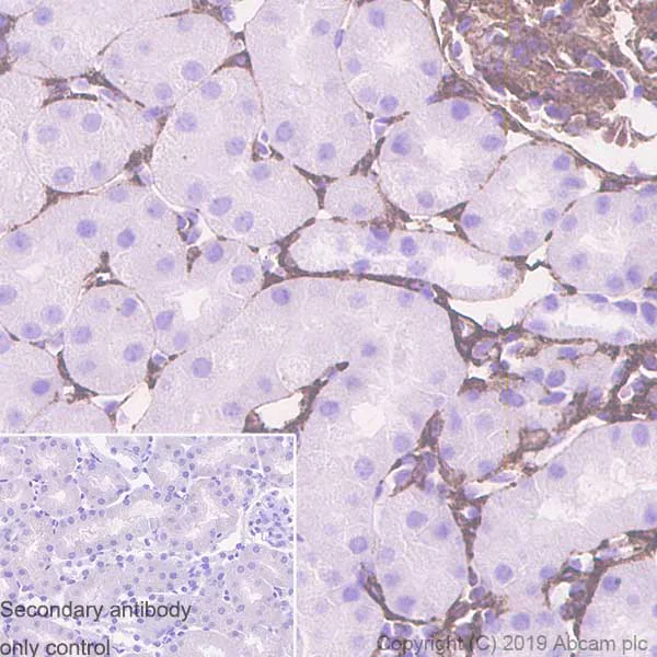 Immunohistochemistry (Formalin/PFA-fixed paraffin-embedded sections) - Anti-Caldesmon/CDM antibody [E89] - BSA and Azide free (AB215275)