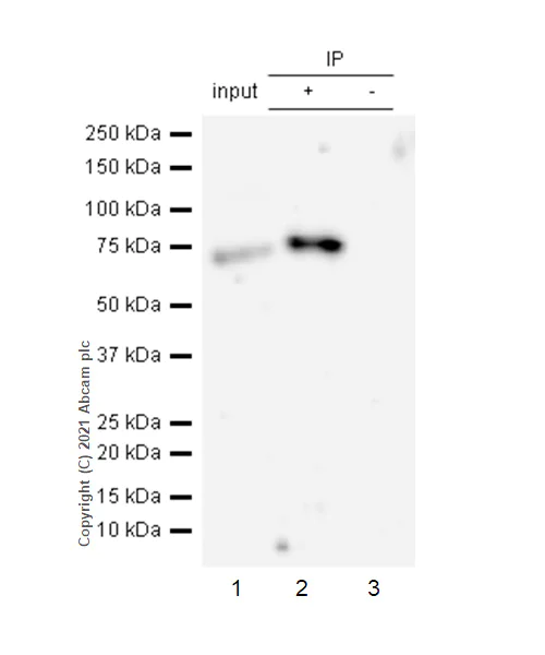 Immunoprecipitation - Anti-Caldesmon/CDM antibody [E89] - BSA and Azide free (AB215275)