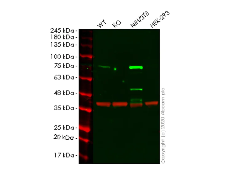 Western blot - Anti-Caldesmon/CDM antibody [E89] - BSA and Azide free (AB215275)