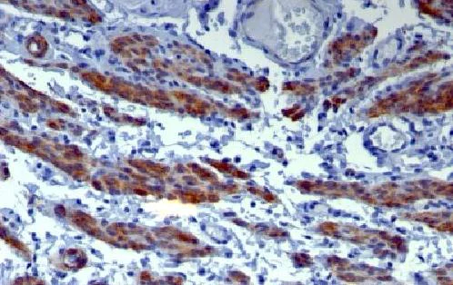 Immunohistochemistry (Formalin/PFA-fixed paraffin-embedded sections) - Anti-Caldesmon/CDM antibody [h-CALD] - BSA and Azide free (AB212964)