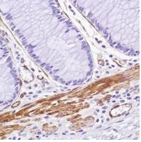 Immunohistochemistry (Formalin/PFA-fixed paraffin-embedded sections) - Anti-Caldesmon/CDM antibody [SP226] - BSA and Azide free (AB238782)