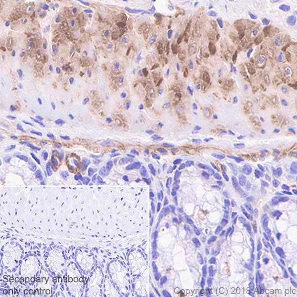 Immunohistochemistry (Formalin/PFA-fixed paraffin-embedded sections) - Anti-Caldesmon/CDM antibody [SP226] - BSA and Azide free (AB238782)