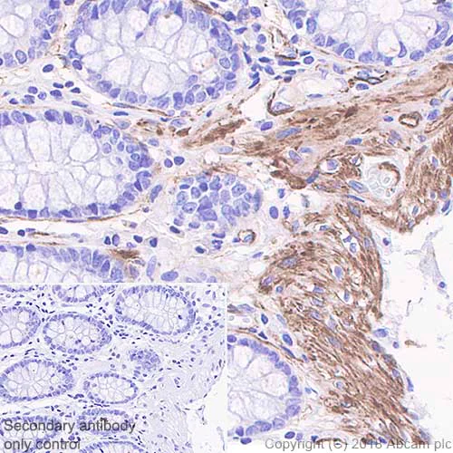 Immunohistochemistry (Formalin/PFA-fixed paraffin-embedded sections) - Anti-Caldesmon/CDM antibody [SP226] - BSA and Azide free (AB238782)
